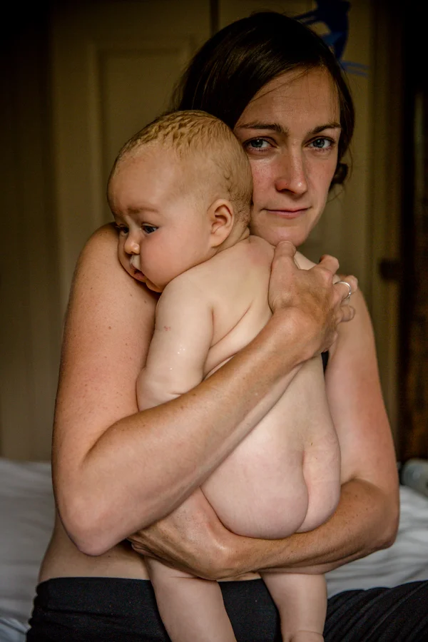 Marks of maternity body and soul