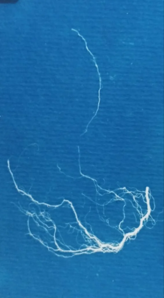 Li Vasc (4)